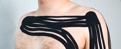 Kinesio taping